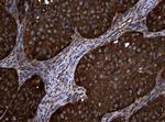 NME1 Antibody in Immunohistochemistry (Paraffin) (IHC (P))
