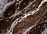 NME1 Antibody in Immunohistochemistry (Paraffin) (IHC (P))
