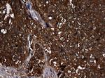 NME1 Antibody in Immunohistochemistry (Paraffin) (IHC (P))