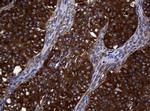 NME1 Antibody in Immunohistochemistry (Paraffin) (IHC (P))