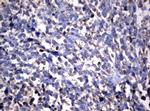 NME1 Antibody in Immunohistochemistry (Paraffin) (IHC (P))