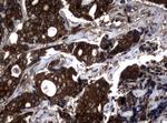 NME1 Antibody in Immunohistochemistry (Paraffin) (IHC (P))