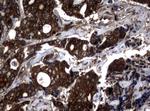 NME1 Antibody in Immunohistochemistry (Paraffin) (IHC (P))