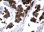 NME1 Antibody in Immunohistochemistry (Paraffin) (IHC (P))