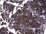 NME1 Antibody in Immunohistochemistry (Paraffin) (IHC (P))
