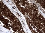 NME1 Antibody in Immunohistochemistry (Paraffin) (IHC (P))