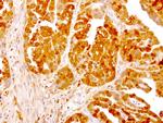 NME1 Antibody in Immunohistochemistry (Paraffin) (IHC (P))