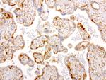 NME1 Antibody in Immunohistochemistry (Paraffin) (IHC (P))