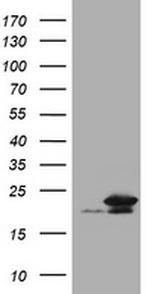 NME1 Antibody in Western Blot (WB)