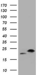 NME1 Antibody in Western Blot (WB)