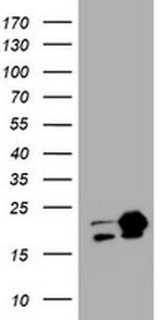 NME1 Antibody in Western Blot (WB)