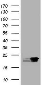 NME1 Antibody in Western Blot (WB)