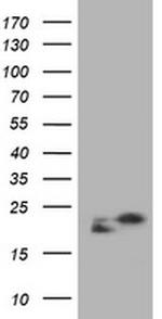 NME1 Antibody in Western Blot (WB)