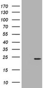 NME1 Antibody in Western Blot (WB)