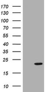 NME1 Antibody in Western Blot (WB)