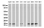 NME1 Antibody in Western Blot (WB)
