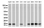 NME1 Antibody in Western Blot (WB)