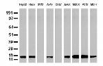 NME1 Antibody in Western Blot (WB)