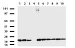 NME1 Antibody in Western Blot (WB)