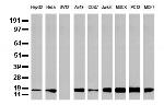 NME1 Antibody in Western Blot (WB)