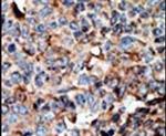 NME2 Antibody in Immunohistochemistry (IHC)