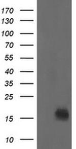 NME2 Antibody in Western Blot (WB)
