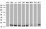 NME2 Antibody in Western Blot (WB)