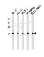 NME2 Antibody in Western Blot (WB)
