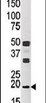 NME3 Antibody in Western Blot (WB)