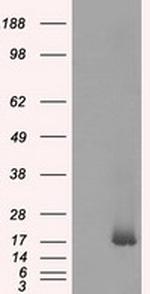 NME4 Antibody in Western Blot (WB)