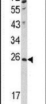 NME4 Antibody in Western Blot (WB)