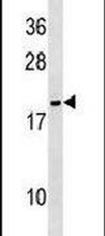 NME6 Antibody in Western Blot (WB)