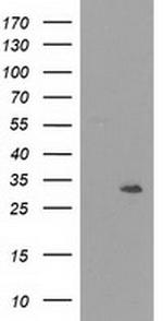 NMNAT1 Antibody in Western Blot (WB)
