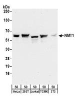 NMT1 Antibody in Western Blot (WB)