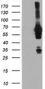 NMT2 Antibody in Western Blot (WB)