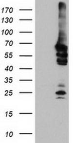 NMT2 Antibody in Western Blot (WB)