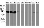 NMT2 Antibody in Western Blot (WB)