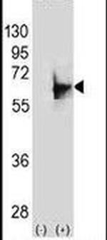 NMT2 Antibody in Western Blot (WB)