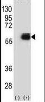 NMT2 Antibody in Western Blot (WB)