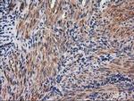 NNMT Antibody in Immunohistochemistry (Paraffin) (IHC (P))