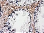 NNMT Antibody in Immunohistochemistry (Paraffin) (IHC (P))