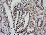 NNMT Antibody in Immunohistochemistry (Paraffin) (IHC (P))