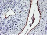 NNMT Antibody in Immunohistochemistry (Paraffin) (IHC (P))
