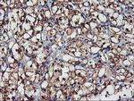 NNMT Antibody in Immunohistochemistry (Paraffin) (IHC (P))