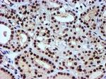NNMT Antibody in Immunohistochemistry (Paraffin) (IHC (P))