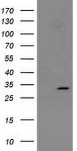 NNMT Antibody in Western Blot (WB)