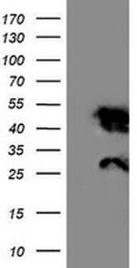 NNMT Antibody in Western Blot (WB)