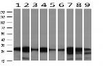 NNMT Antibody in Western Blot (WB)