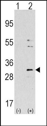 NNMT Antibody in Western Blot (WB)