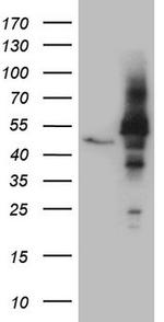 NOB1 Antibody in Western Blot (WB)